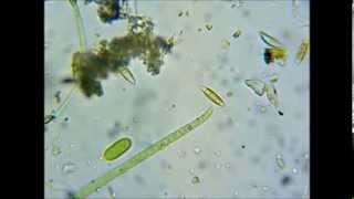 Motile cyanobacteria + diatoms