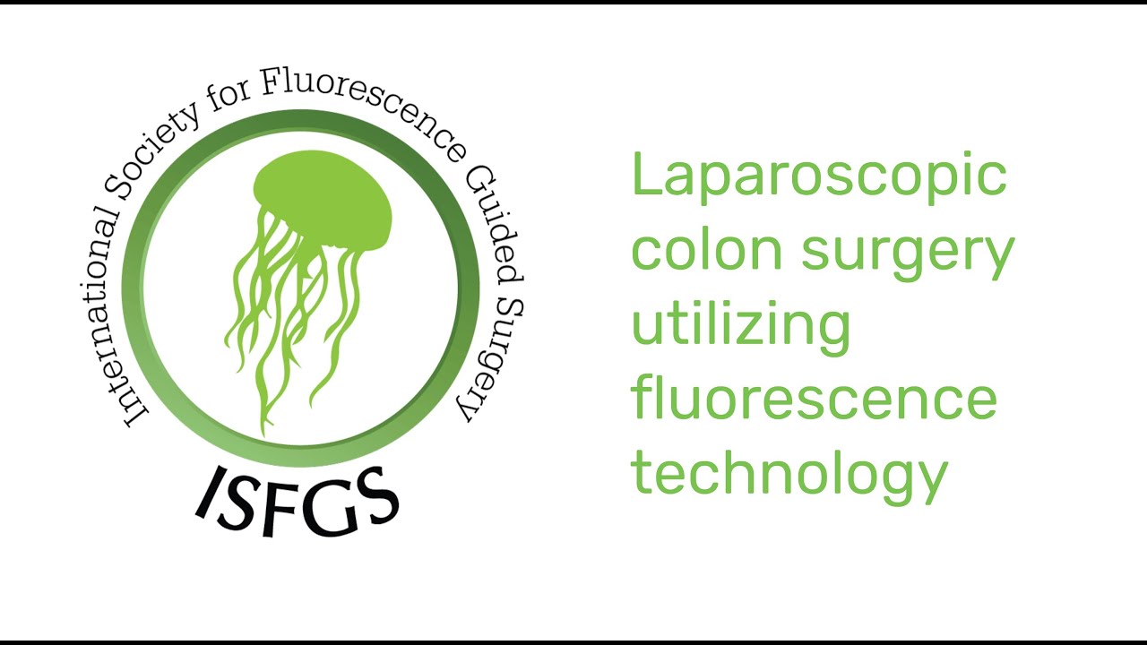 Colon Surgery Using Fluorescence Guided Surgery Explained - YouTube