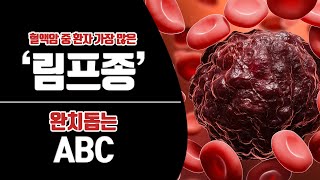 [힐팁 TV] 혈액암 중 환자 가장 많아요‘림프종’ 완치 돕는 ABC