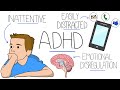 Understanding Attention Deficit Hyperactivity Disorder (ADHD)