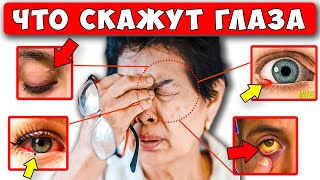 Болезни по ГЛАЗАМ. 15 признаков, которые расскажут о Проблемах...