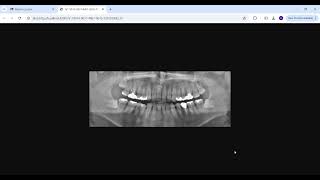 23-  تنفيذ إجراءات الأسنان -  الجزء الثاني