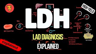 LACTATE DEHYDROGENASE Clinical significance Why LDH increase ?