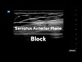 Serratus Anterior Plane Block