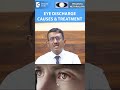 eye discharge most common causes u0026 treatment dr. sriram ramalingam doctors circle shorts