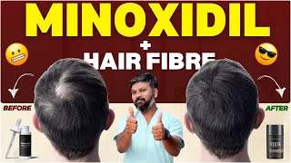 #AskDrJohnWatts | MINOXIDIL + HAIR FIBRE | Hair Specialist Explains