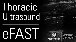 Thoracic Ultrasound