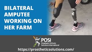 Bilateral Amputee Working on Her Farm | Prosthetic Orthotic Solution International