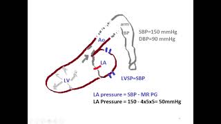 Answer to Question 7- how to calculate LVSP and LA pressure by SBP \u0026 MR