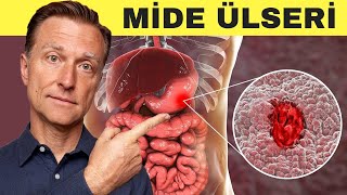 Mide ülserini nasıl iyileştirebilirim? | Dr.Berg Türkçe