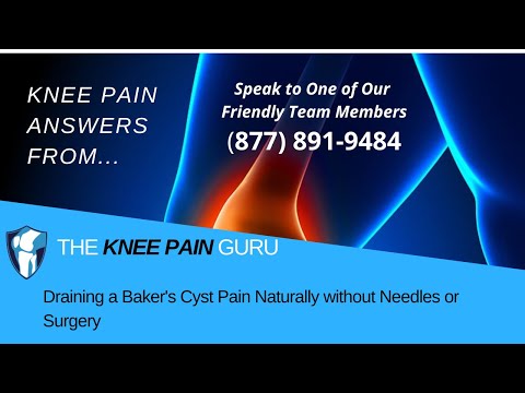 Draining a Baker's Cyst Pain Naturally without Needles or Surgery Draining a Baker's Cyst Pain Naturally without Needles or Surgery
