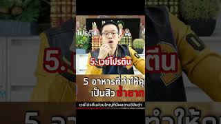 5 อาหารที่ทำให้คุณเป็นสิวซ้ำซาก