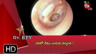 Dr.ETV - Reasons for pus in the ear - 11th May 2016 - డాక్టర్ ఈటివీ