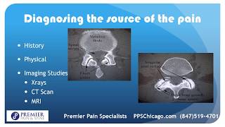 Medial Branch Block Explained by a Chicago Pain Clinic (847) 519-4701