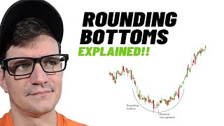 What is a Rounding Bottom in Trading?