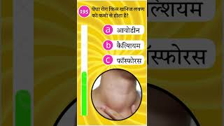 195. घेंघा रोग किस खनिज लवण की कमी से होता है? Goiter is caused by deficiency of which mineral salt?