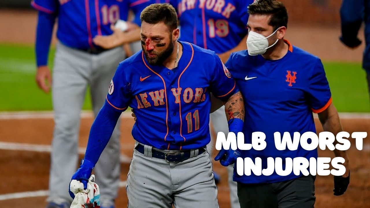 MLB Worst Injuries || MLB 2021ᴴᴰ - YouTube