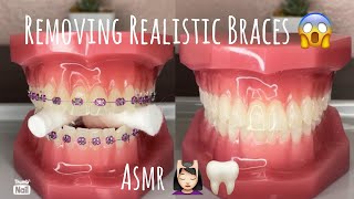 ASMR | Ortho Visit | Removing braces and placing lingual permanent retainer