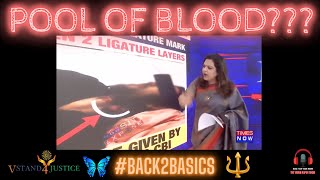 #Back2Basics: The Pool Of Blood | Morphed Pics of #SSR Vs. The Real Ones