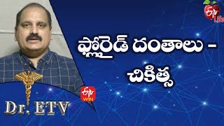 Fluoride Teeth - Treatment | ఫ్లోరైడ్ దంతాలు - చికిత్స | Dr.ETV | 26th January 2022 | ETV Life