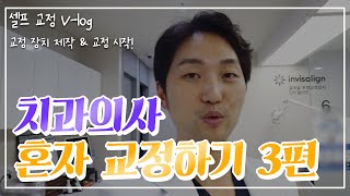 [V-log] 치과의사 혼자 셀프 교정하기 - 교정 장치만들기 (3탄) #교정 장치 끼우는 날 😬투명교정😃부분교정