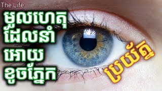 អ្វីជាជំងឺភ្នែក? មូលហេតុមួយចំនួនដែលនាំអោយខូចភ្នែក ឬមានបញ្ហាភ្នែក