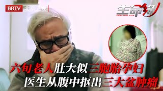 六旬老人肚大似三胞胎孕妇，医生从腹中抠出三大盆肿瘤，老伴看了瞬间崩溃【生命缘 2015】