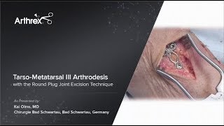 Tarso-Metatarsal III Arthrodesis with the Round Plug Joint Excision Technique