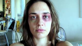 Serbian woman takes self pictures daily while being beaten