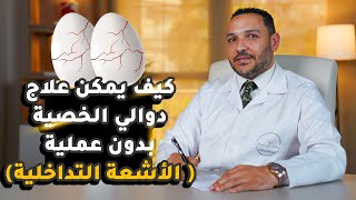 كيف يمكن علاج دوالي الخصية بدون عملية (الأشعة التداخلية )