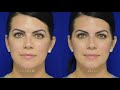 Liquid Rhinoplasty - New Orleans Dr Sean Weiss