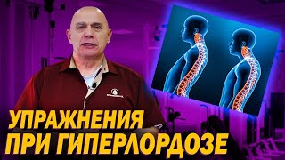 Как лечить гиперлордоз поясничного отдела? Профилактические упражнения для здоровья позвоночника