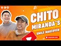 Chito Miranda's Smile Makeover | Dr. RFD