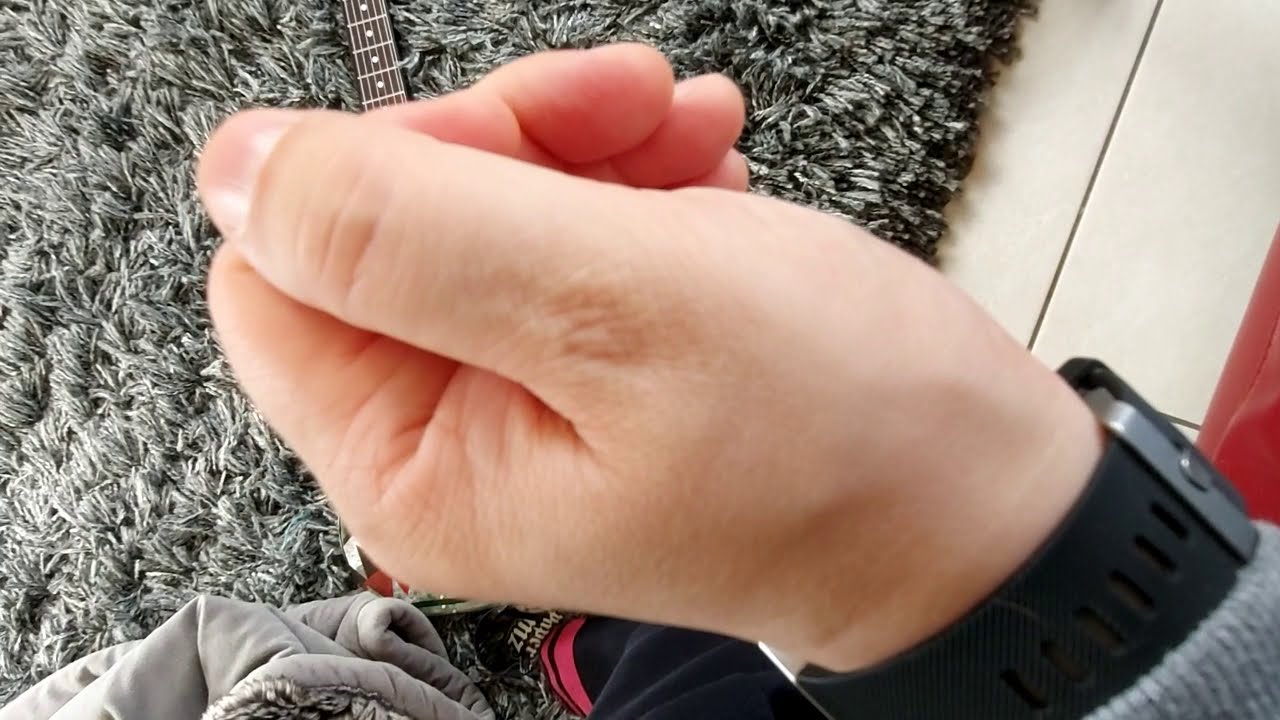 Thumb Twitching. Nerve Issue? - YouTube