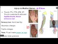 Nerve Injuries of Upper Limb   part 3   median nerve