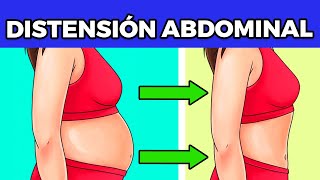 Como reducir la distension abdominal rapidamente