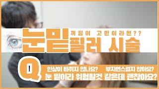 다크서클, 눈밑꺼짐이 고민이라면 봐야할 필수영상 ! 눈밑필러, 괜찮을까요? 바로 시술해서 보여드려요! #눈밑필러 #다크서클필러 #다크써클 #다크써클개선