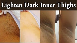 काली जांघो को गोरा करने का जबरदस्त नुस्खा How to Get Rid Darkness Inner Thighs (100% working)