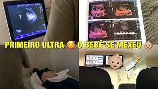 PRIMEIRO ULTRASSOM - 10 SEMANAS - ESCUTANDO O CORAÇÃO | VLOG