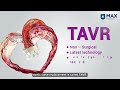 tavr non surgical aortic valve replacement dr. sudheer saxena max hospital mohali