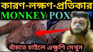 মাঙ্কি ভাইরাস! মাঙ্কি পক্স ভাইরাস কি | মাঙ্কি পক্স ভাইরাস এর লক্ষণ | মাঙ্কি পক্স থেকে বাঁচার উপায় |