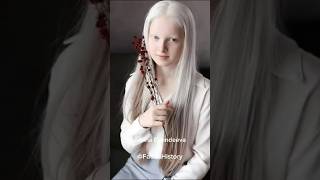 Amina Ependieva, a beautiful Russian albino girl #facts #history #shorts #beautiful