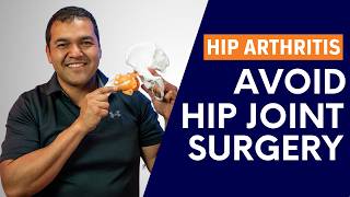 Is It Really Possible To Avoid Hip Joint Replacement Surgery?