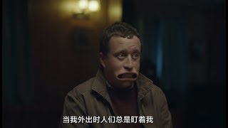 血的教训告诉你：千万不要经常做鬼脸，真的会出事的！