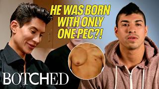 Justin Jedlica Returns to Create An Implant for Albert’s Missing Pec (Before & After) | Botched | E!