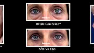 Jeunesse® Global LUMINESCE™ Amazing Before \u0026 After Photos