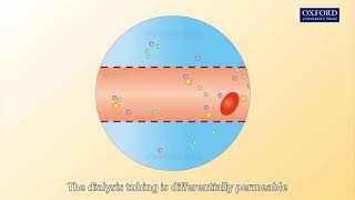 Animation E1, 1.2 How does a dialysis machine work?