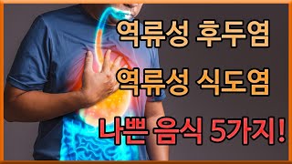 역류성 후두염(인후두 역류 질환), 역류성 식도염에 나쁜 음식 5가지 | 역류질환 예방법 | 오공작가