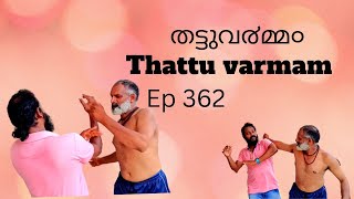 learn kalari marma fight|തട്ടു മ൪മ്മ൦| varma kalari| vinayangurukkal