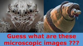 Guess what these microscopic images are  ???